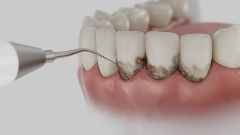 Trusted Dental Crowns And Bridges service in Mira Monte, CA - Dentist Open Now